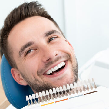 Are Crowns Better Than Veneers?